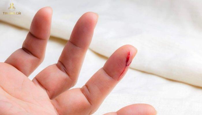 Chảy máu đánh con gì khi mơ đứt tay
